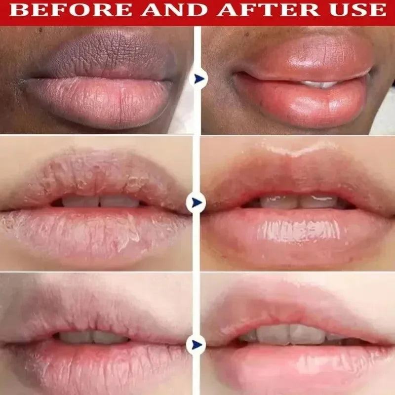 5x Nicotinamide Remove Dark Lip Balm Anti Cracking Gloss Powder Lip Mask Exfoliating Moisturizing Lipstick  Reduce Lip Lines ﻿