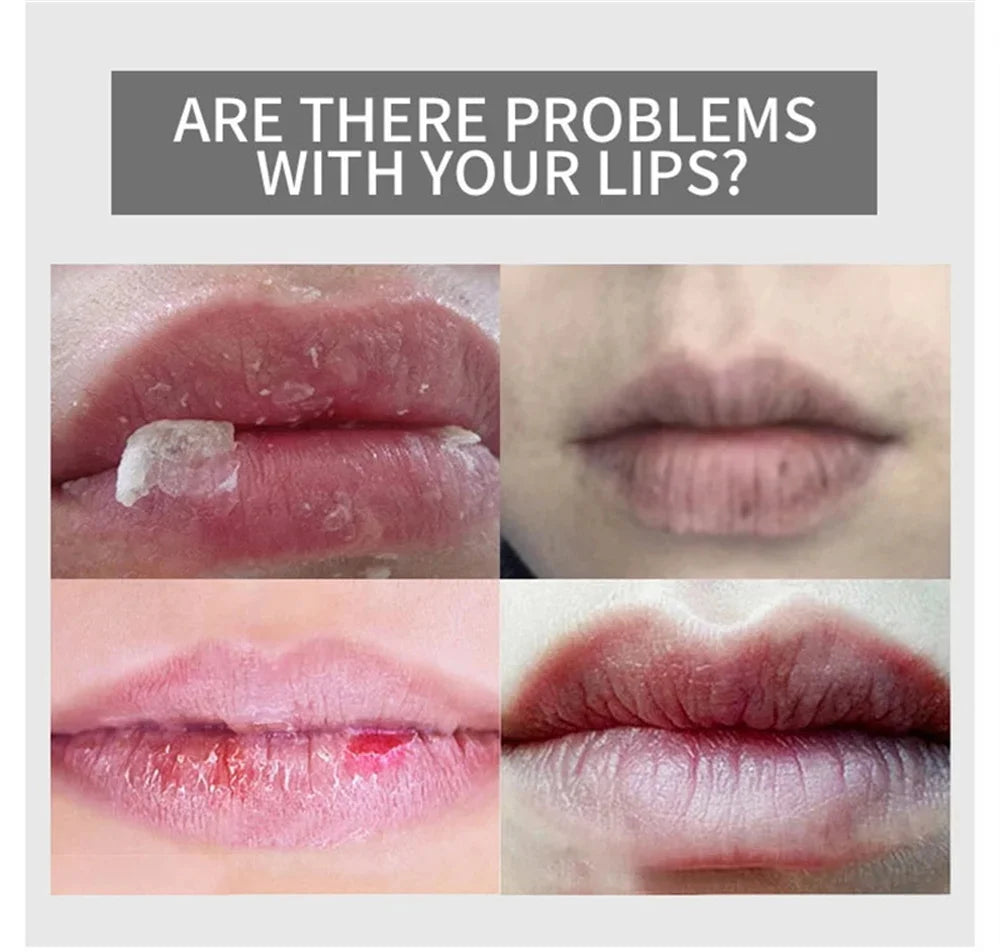 Hyaluronic Acid Collagen Sleep Lip Mask 20g Deep Hydration Lasting Moisturizing Exfoliation Day And Night Can Be Given As A Gift